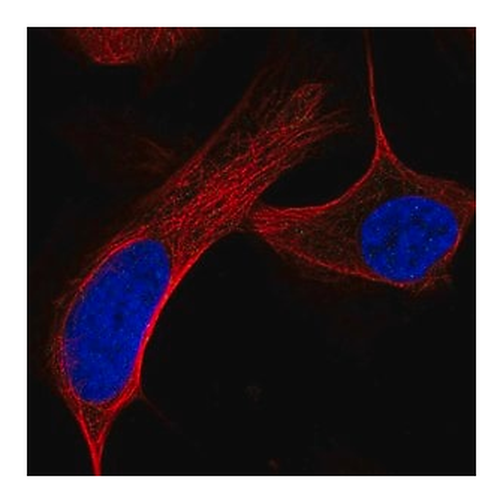 Merck Anti-ATM antibody produced in rabbit
