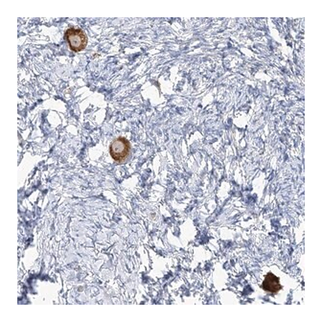 Merck Anti-TMEM209 antibody produced in rabbit