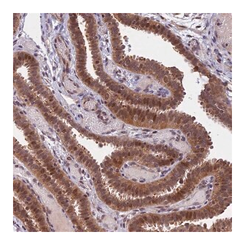 Merck Anti-CCDC113 antibody produced in rabbit