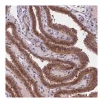 Merck Anti-CCDC113 antibody produced in rabbit