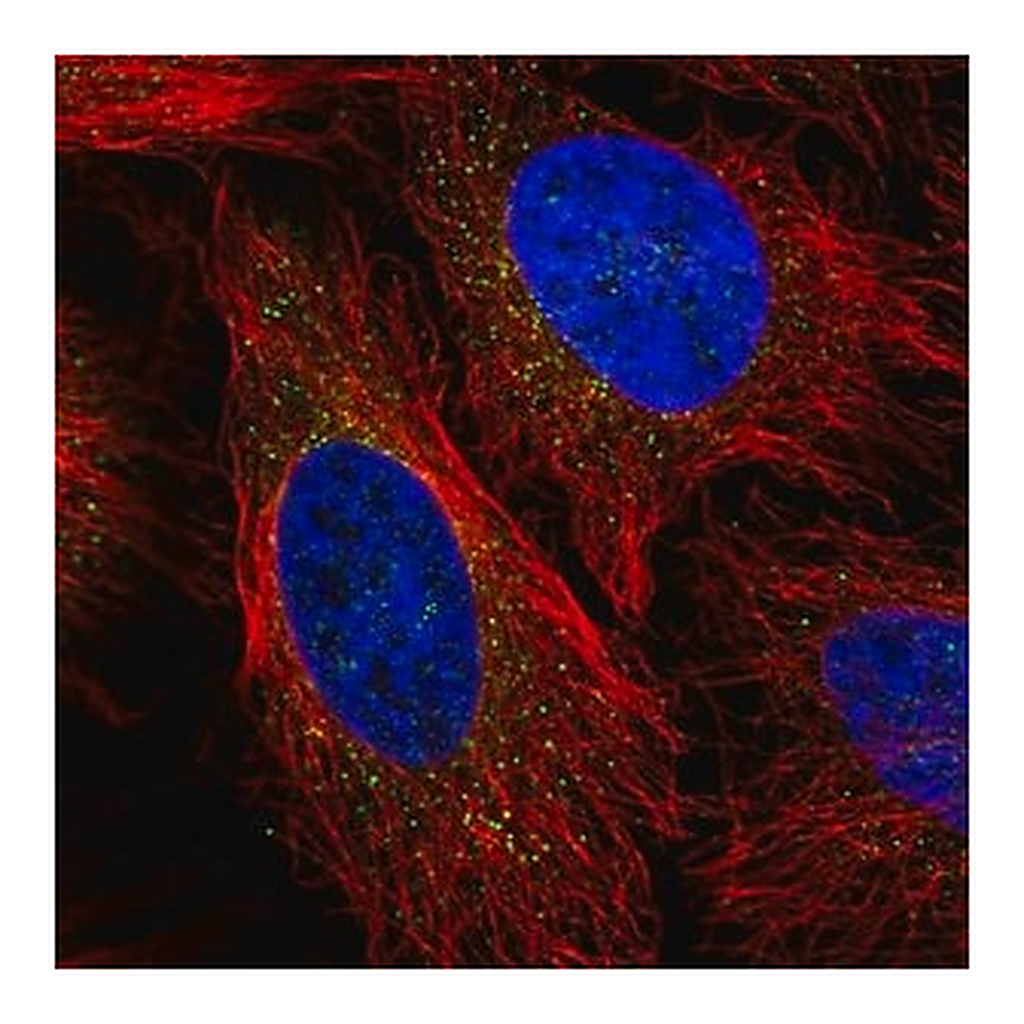Merck Anti-LPL antibody produced in rabbit