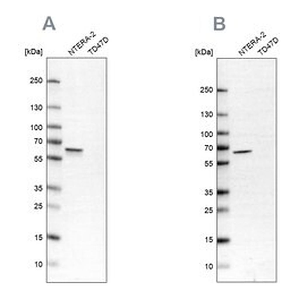 Merck Anti-UPF3B antibody produced in rabbit