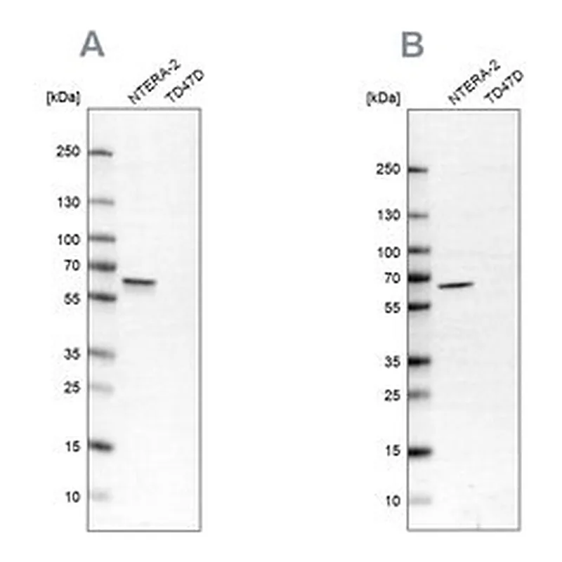 Merck Anti-UPF3B antibody produced in rabbit