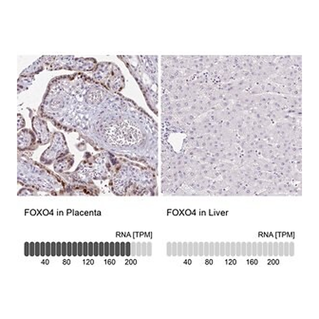 Merck Anti-FOXO4 antibody produced in rabbit