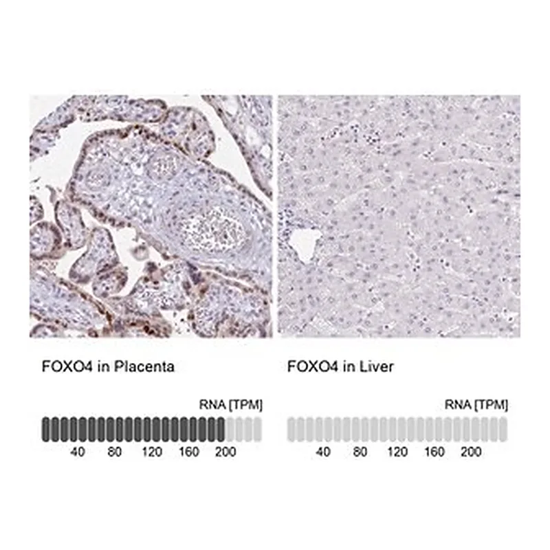 Merck Anti-FOXO4 antibody produced in rabbit