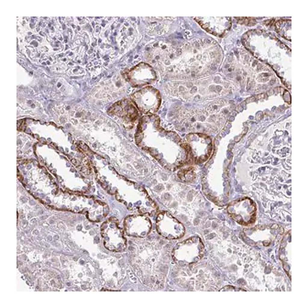Merck Anti-RNASEH1 antibody produced in rabbit