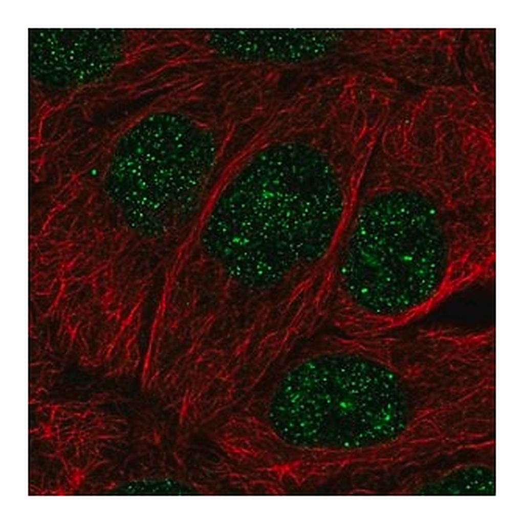 Merck Anti-MBD2 antibody produced in rabbit