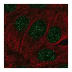 Merck Anti-MBD2 antibody produced in rabbit