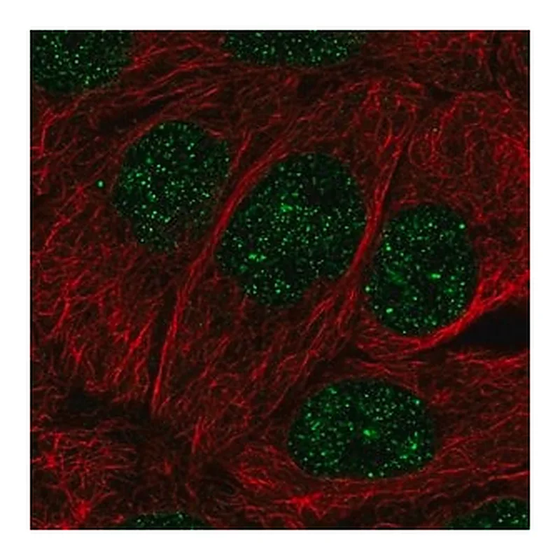 Merck Anti-MBD2 antibody produced in rabbit