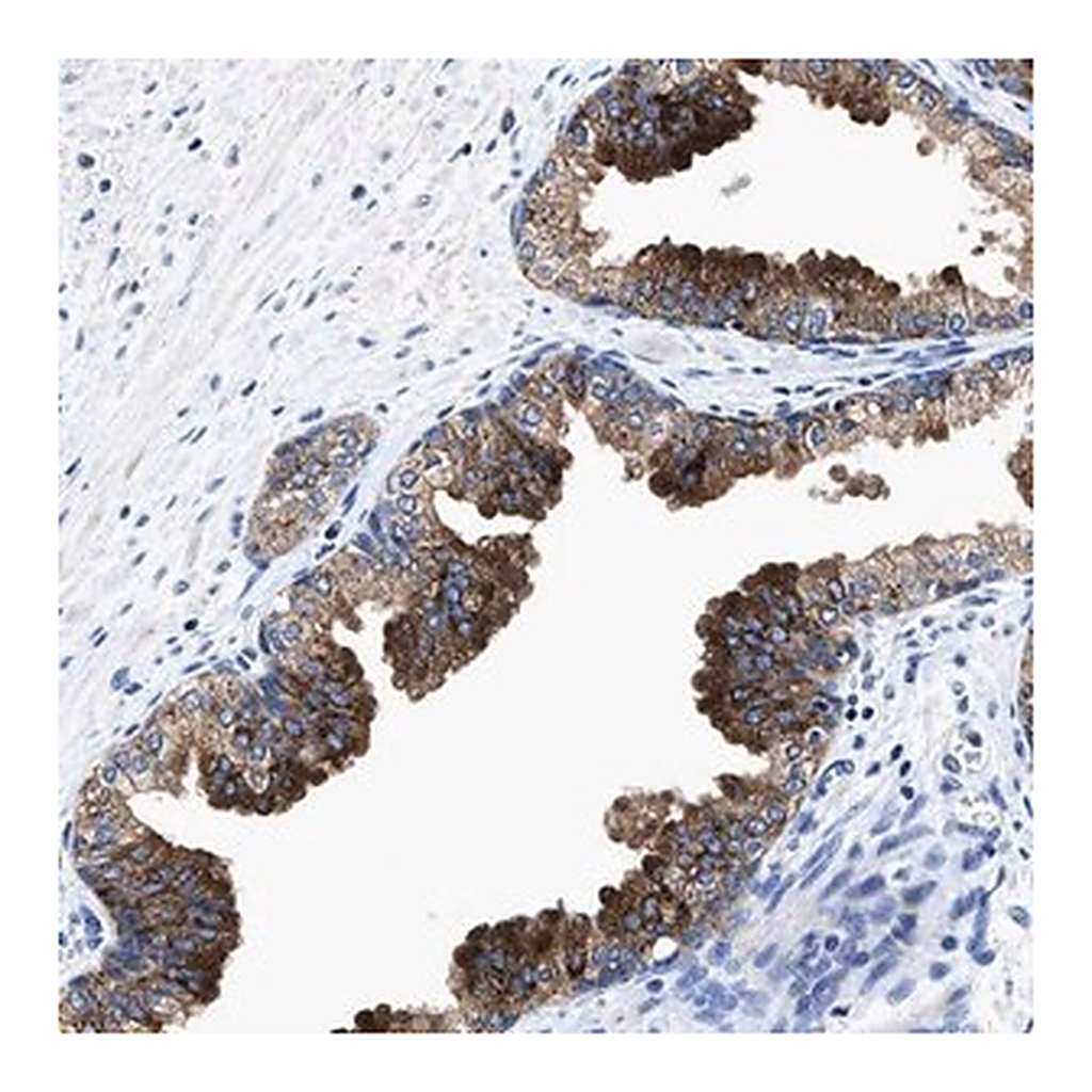Merck Anti-UBR4 antibody produced in rabbit