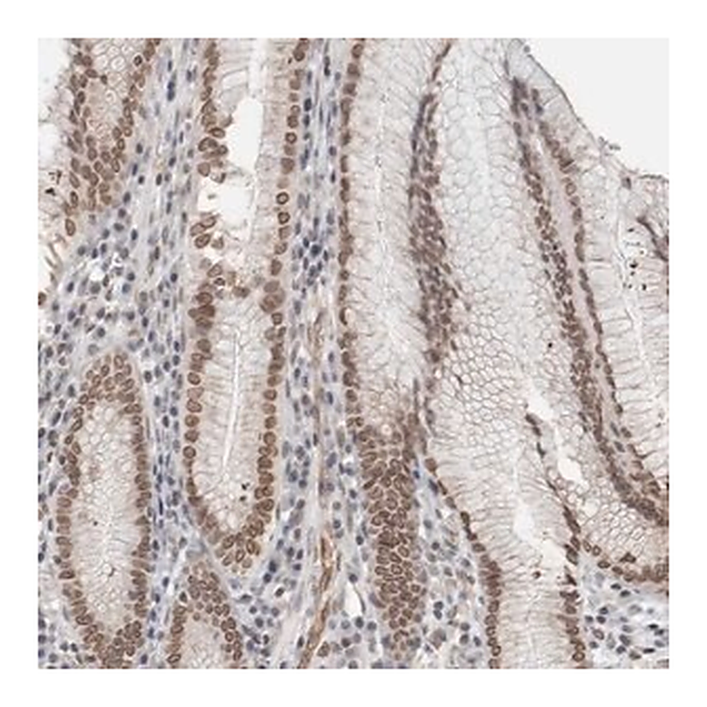 Merck Anti-RBMX2 antibody produced in rabbit