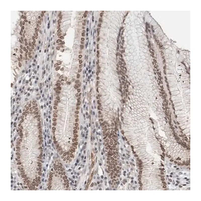 Merck Anti-RBMX2 antibody produced in rabbit