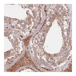 Merck Anti-CEP295 antibody produced in rabbit