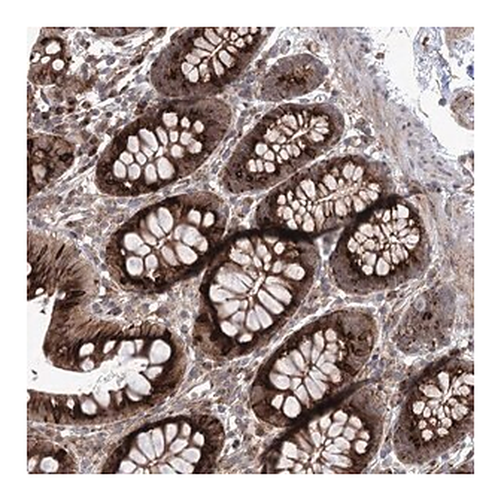 Merck Anti-PARM1 antibody produced in rabbit