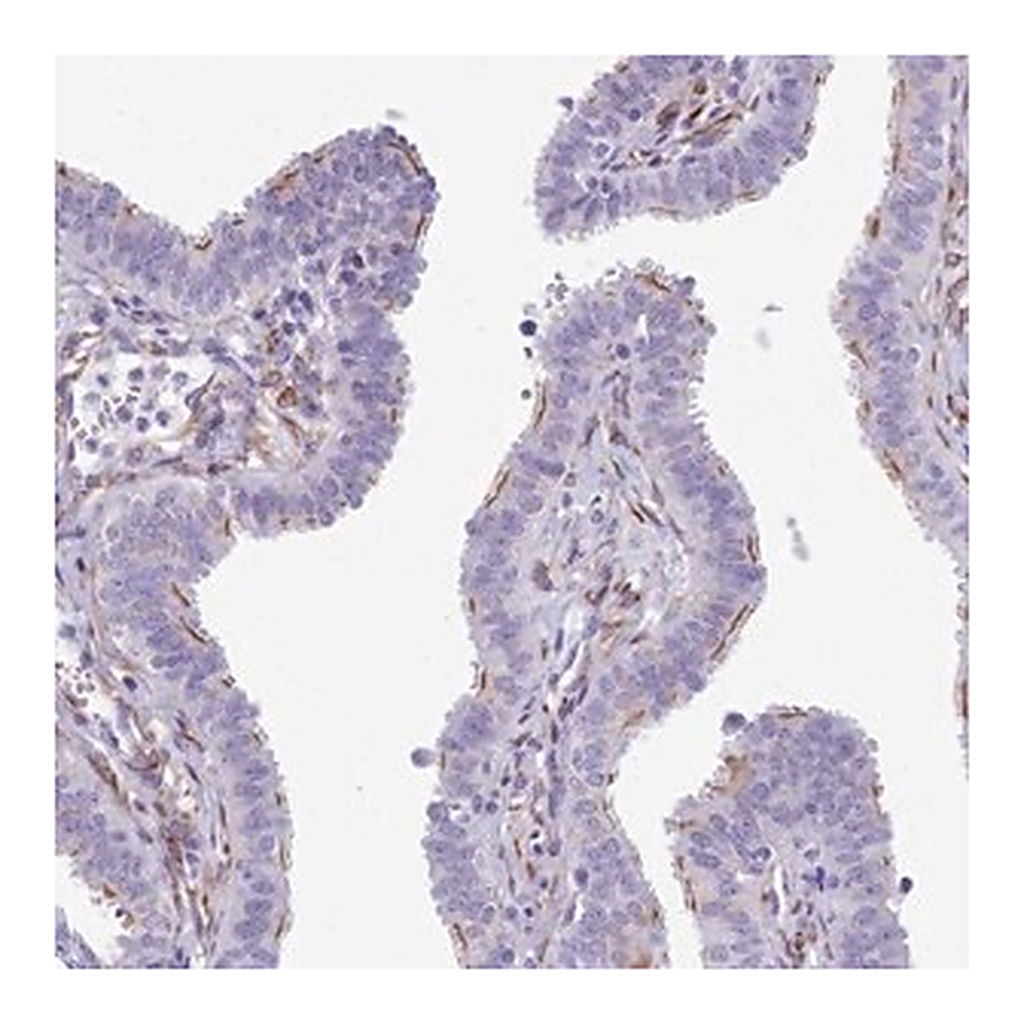 Merck Anti-CC2D2A antibody produced in rabbit
