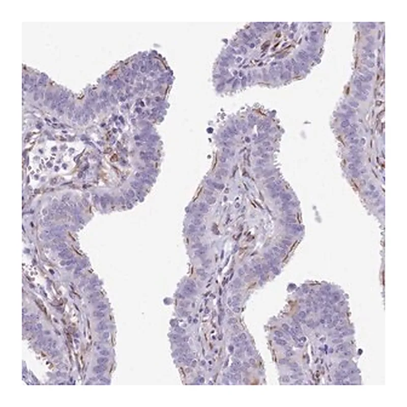 Merck Anti-CC2D2A antibody produced in rabbit