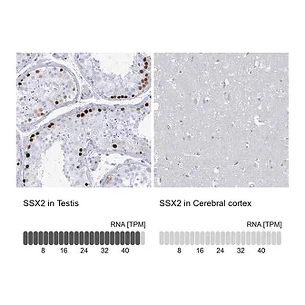 Merck Anti-SSX2 antibody produced in rabbit