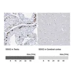 Merck Anti-SSX2 antibody produced in rabbit