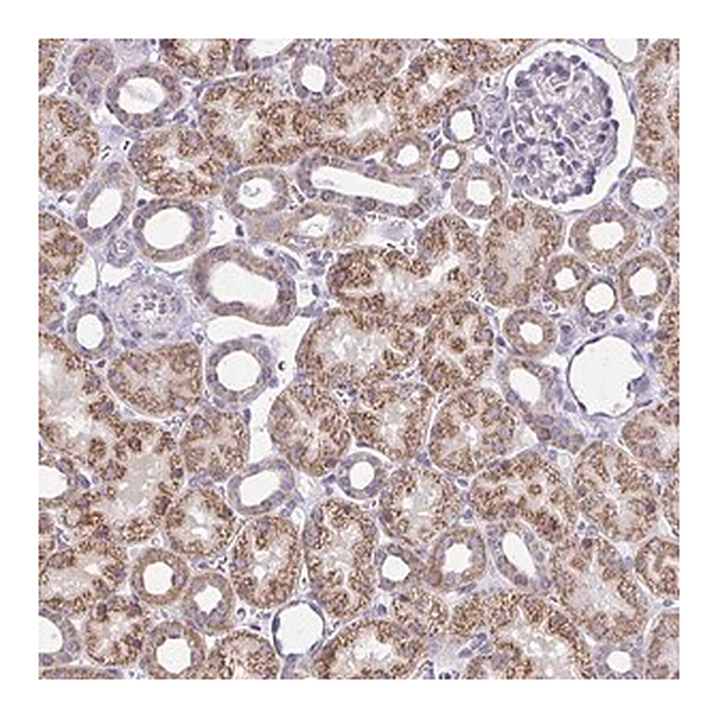 Merck Anti-IFIT1 antibody produced in rabbit