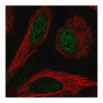 Merck Anti-TBL1X antibody produced in rabbit