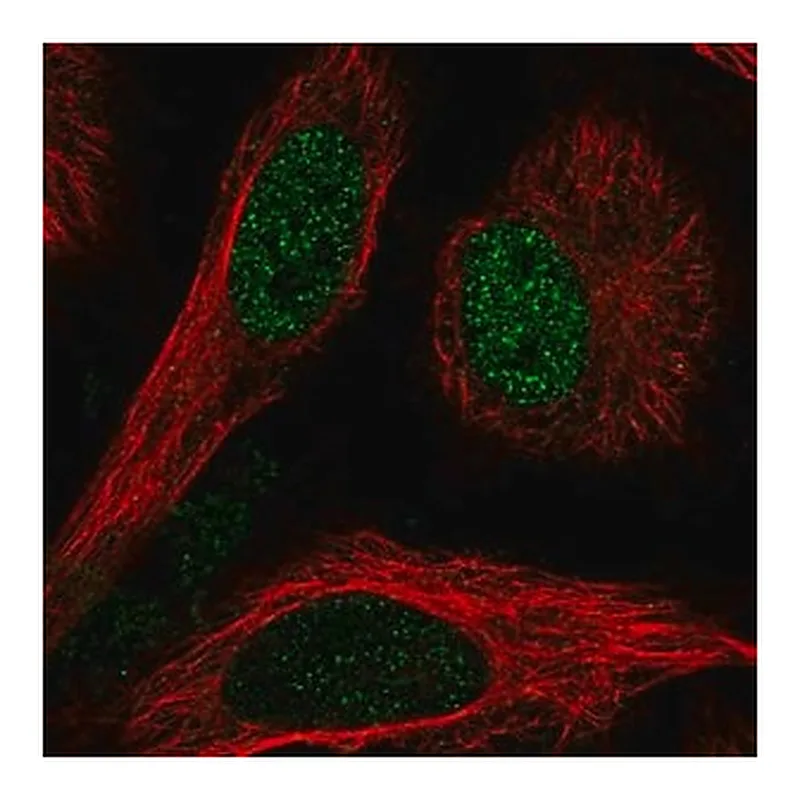 Merck Anti-TBL1X antibody produced in rabbit