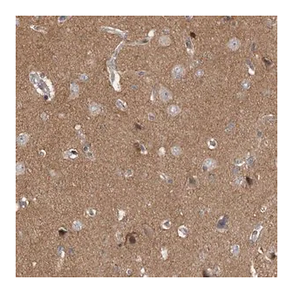 Merck Anti-PPP1R9A antibody produced in rabbit