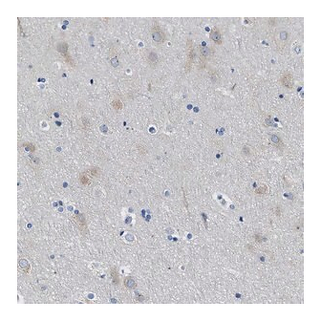 Merck Anti-ITPR1 antibody produced in rabbit