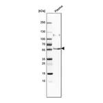 Merck Anti-PI16 antibody produced in rabbit