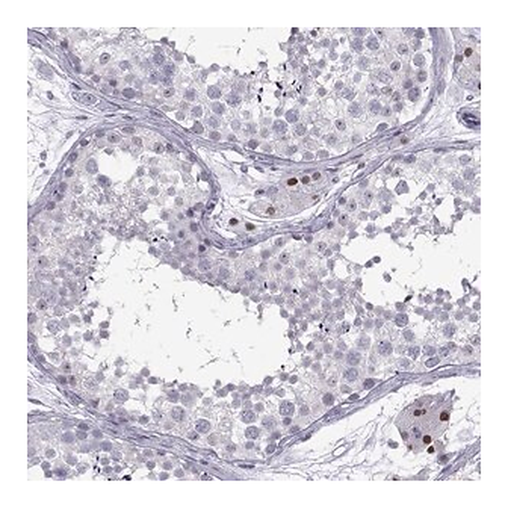 Merck Anti-C16orf59 antibody produced in rabbit
