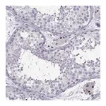 Merck Anti-C16orf59 antibody produced in rabbit