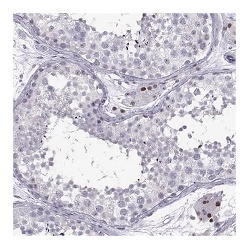 Merck Anti-C16orf59 antibody produced in rabbit