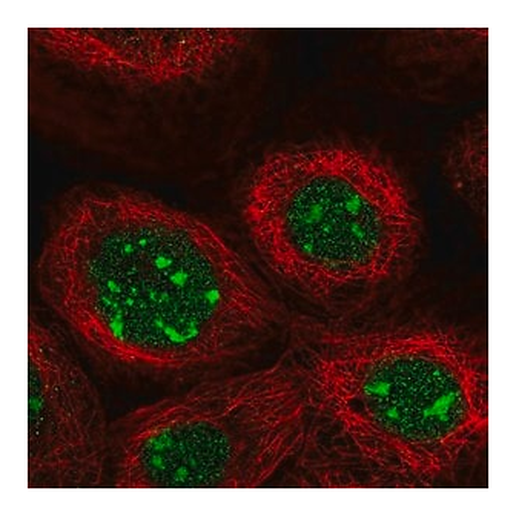Merck Anti-GPATCH4 antibody produced in rabbit