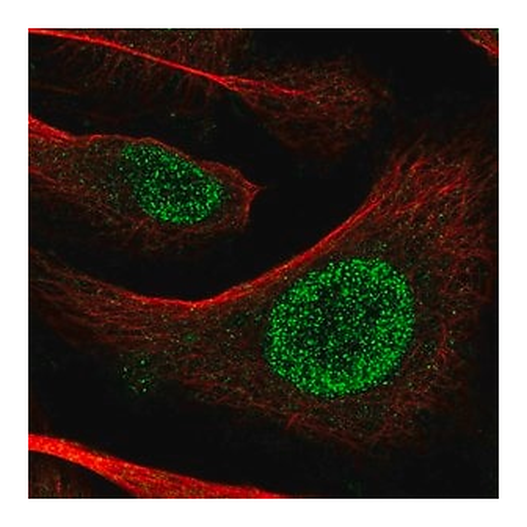 Merck Anti-POT1 antibody produced in rabbit