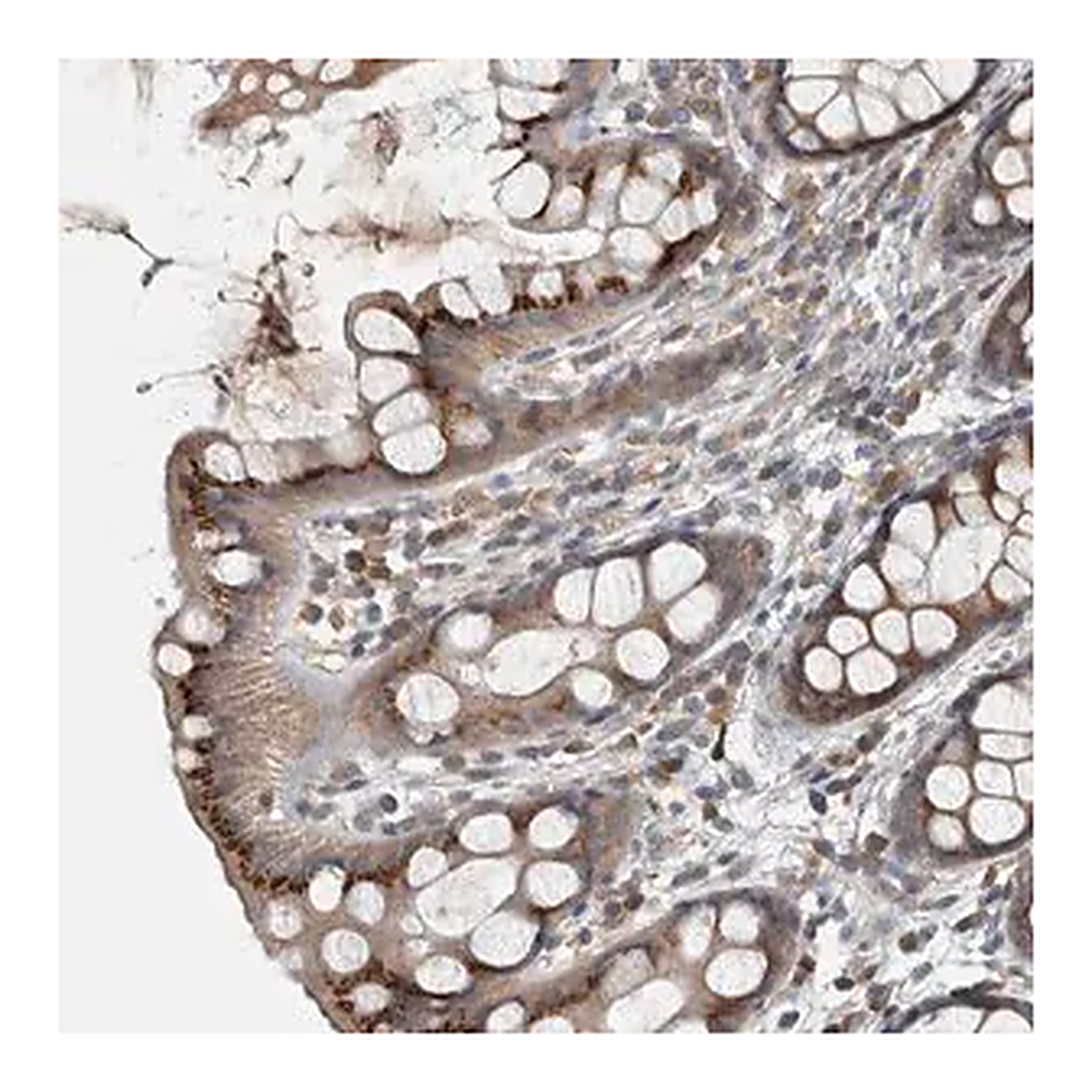 Merck Anti-CLCN2 antibody produced in rabbit