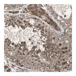 Merck Anti-ZNF608 antibody produced in rabbit