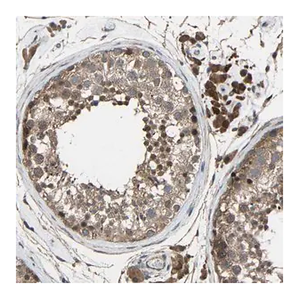 Merck Anti-CHST9 antibody produced in rabbit