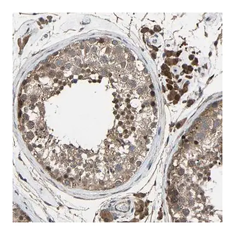 Merck Anti-CHST9 antibody produced in rabbit
