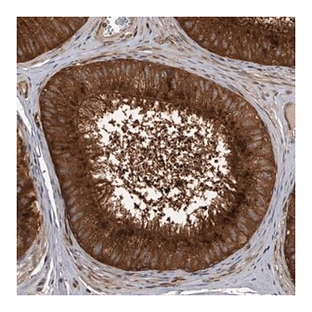 Merck Anti-DHDDS antibody produced in rabbit