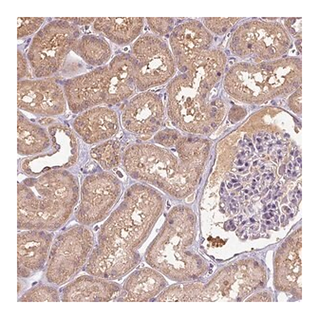 Merck Anti-TSEN54 antibody produced in rabbit