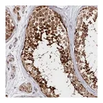 Merck Anti-KATNA1 antibody produced in rabbit