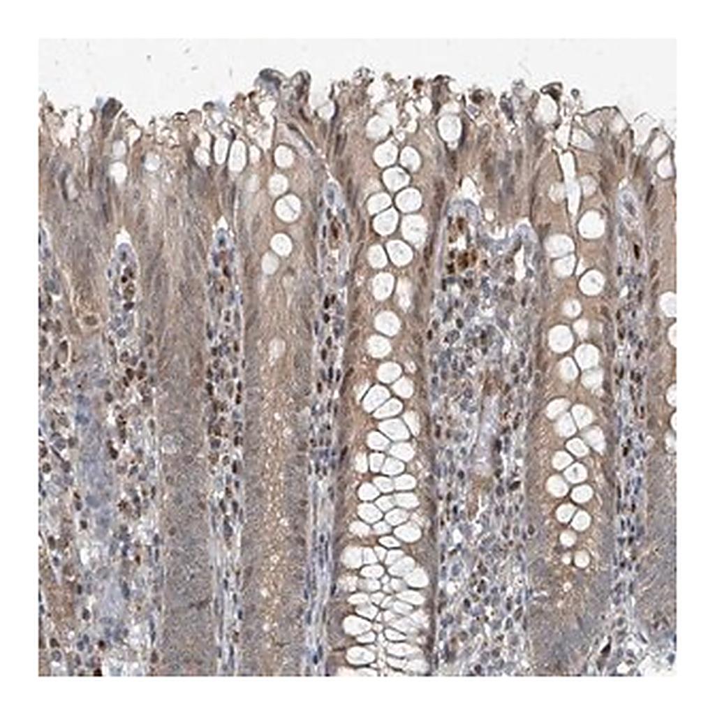 Merck Anti-RHPN2 antibody produced in rabbit