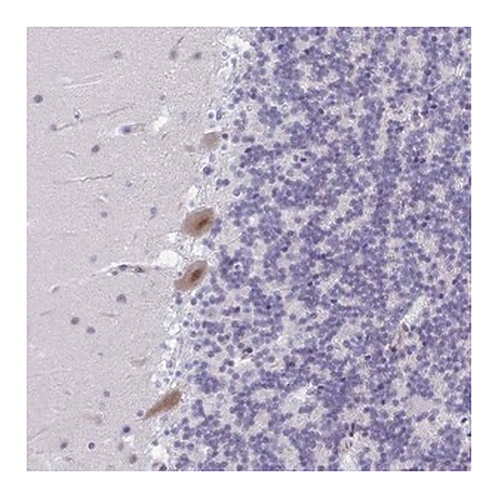 Merck Anti-PHRF1 antibody produced in rabbit