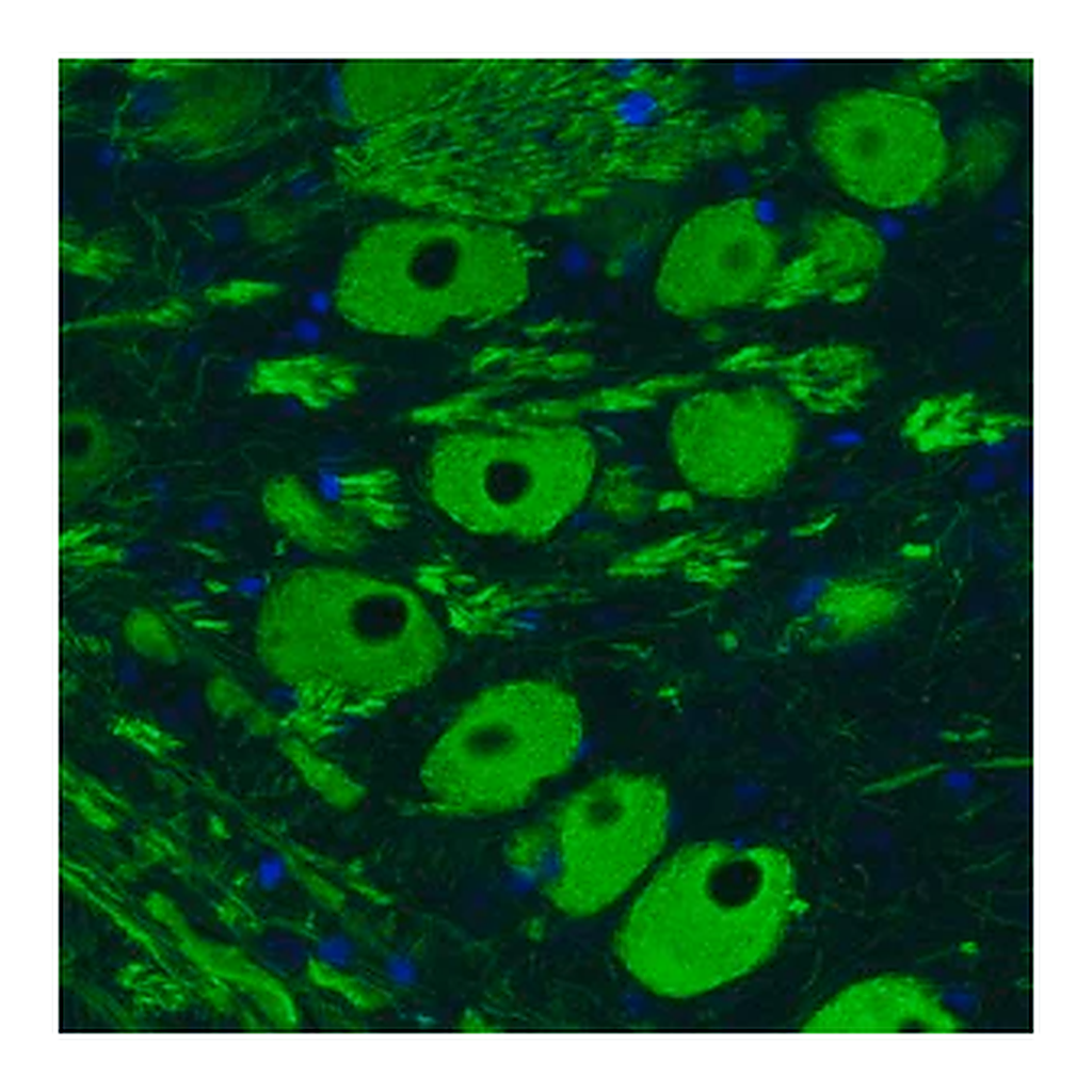 Merck Monoclonal Anti-NEFM antibody produced in mouse