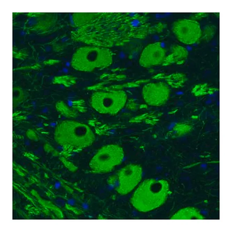Merck Monoclonal Anti-NEFM antibody produced in mouse