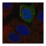 Merck Anti-TACR2 antibody produced in rabbit