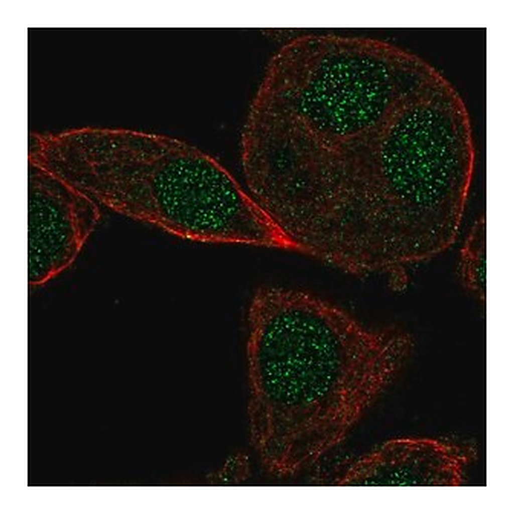 Merck Anti-CYB5RL antibody produced in rabbit