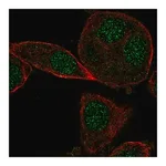 Merck Anti-CYB5RL antibody produced in rabbit