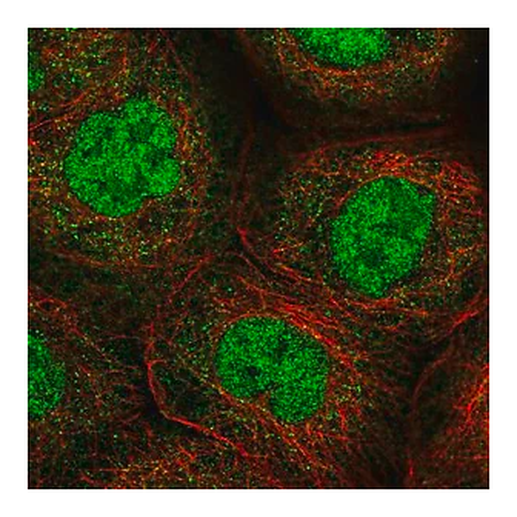 Merck Anti-ANKRD11 antibody produced in rabbit
