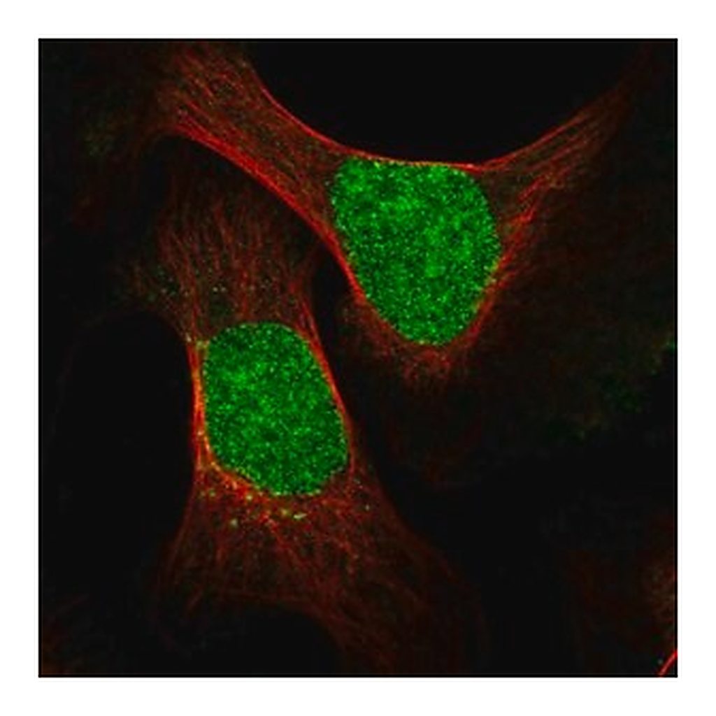 Merck Anti-ESCO2 antibody produced in rabbit
