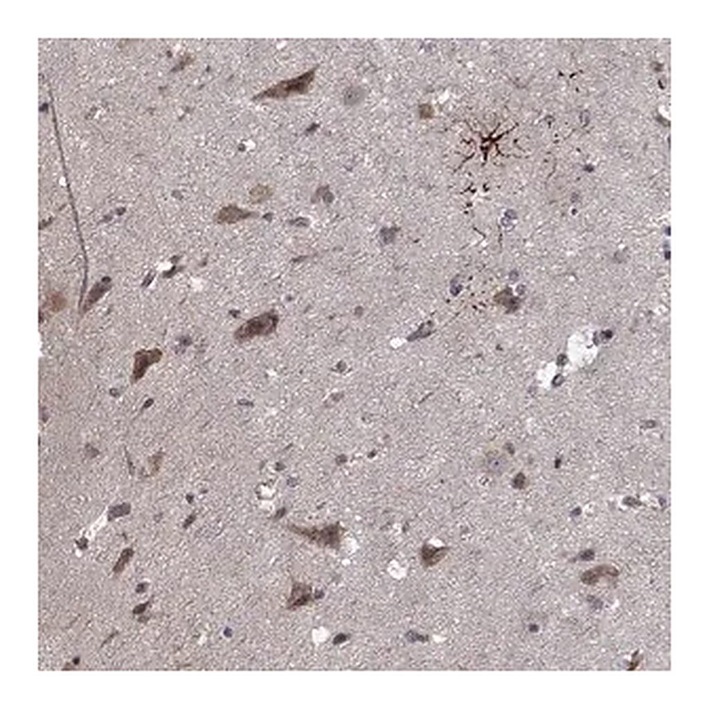 Merck Anti-NLK antibody produced in rabbit